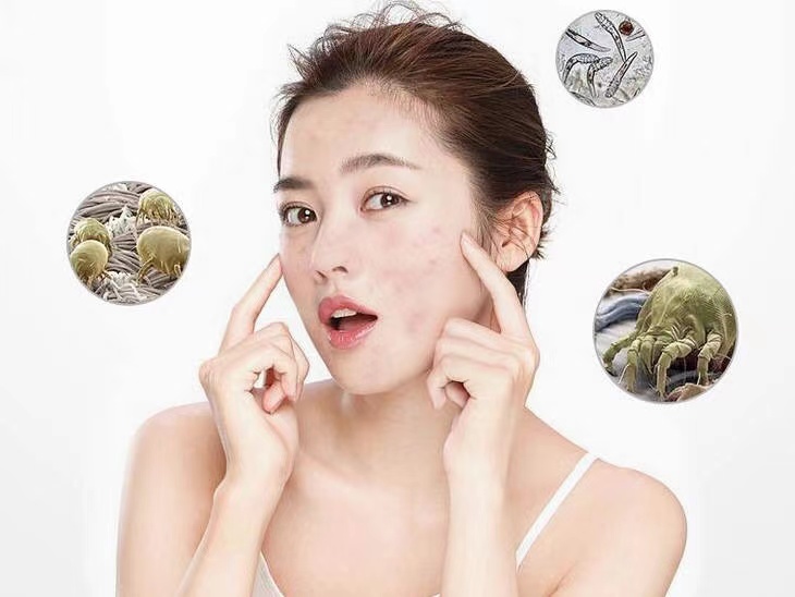 皮膚經(jīng)常過敏，長痘？警惕是新房裝修原因！